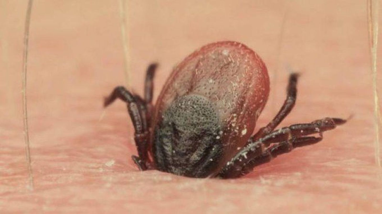 El Hospital de Salamanca trata en menos de un año cuatro de los ocho casos de fiebre hemorrágica de Crimea-Congo registrados en España desde 2016