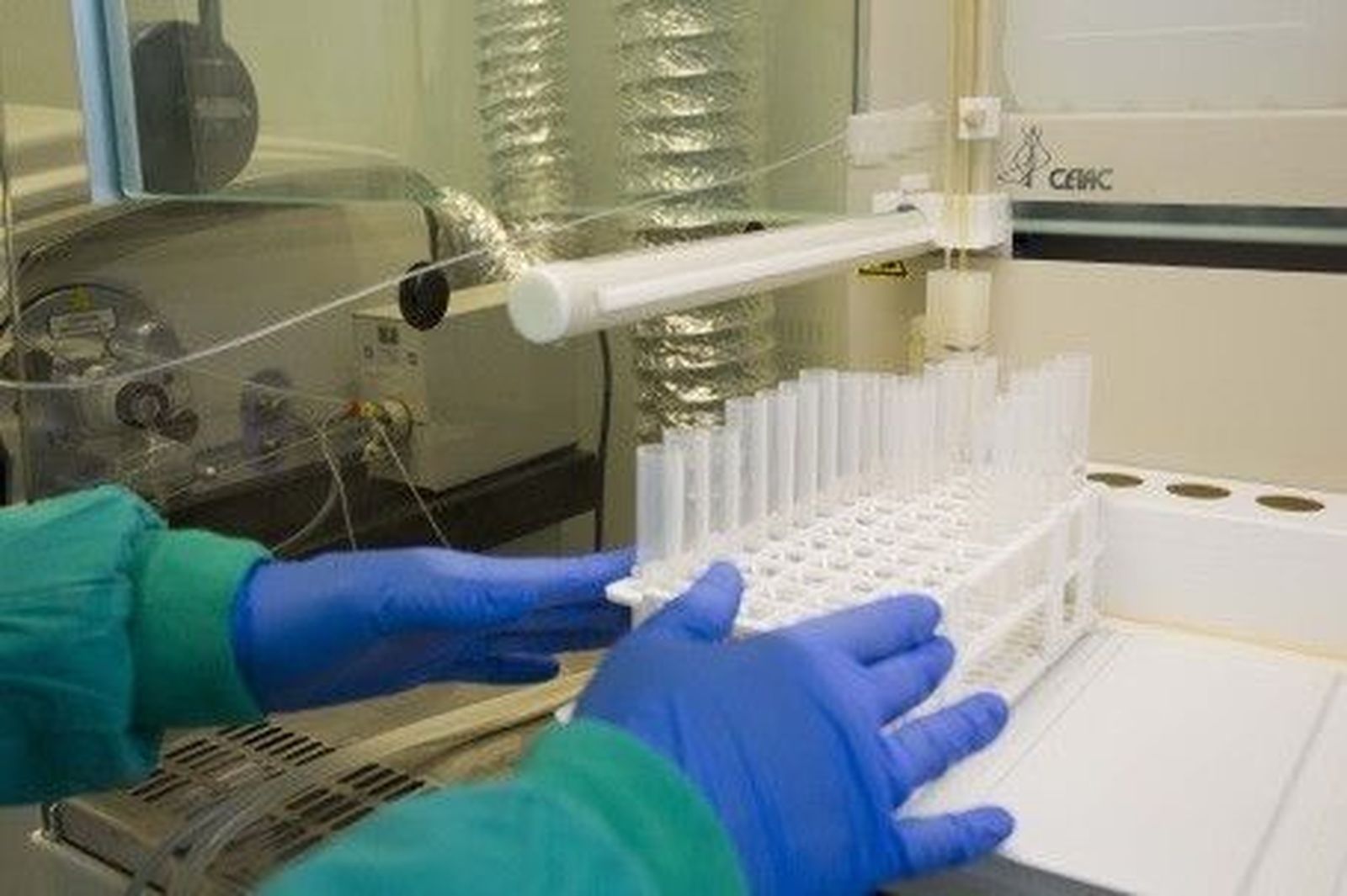 Nuevas ayudas para fomentar proyectos de investigación sanitaria