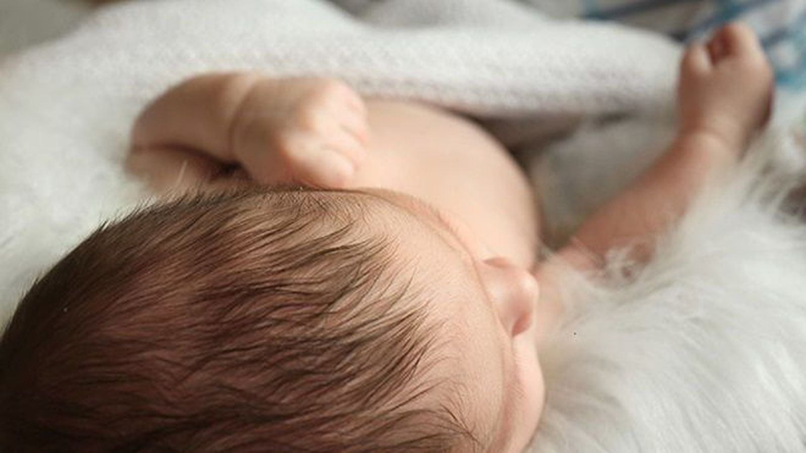 Minoxidil y el "síndrome de hombre lobo" en los bebés