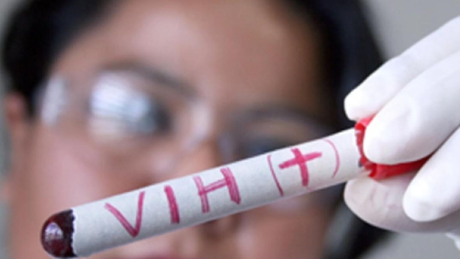 VIH. Foto EP