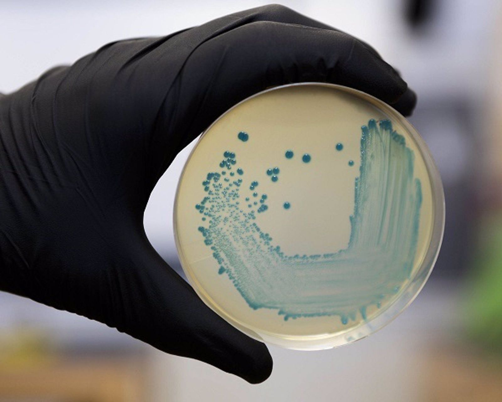 Food Safety Pathogen Listeria Monocytogenes Isolated On Agar From A Food Sample. - RECTORADO UNIVERSIDAD COMPLUTENSE - Archivo EP