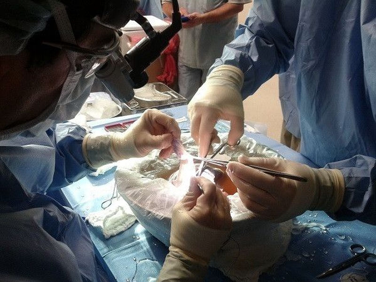 El programa de trasplante hepático alcanza el medio millar en la Comunidad