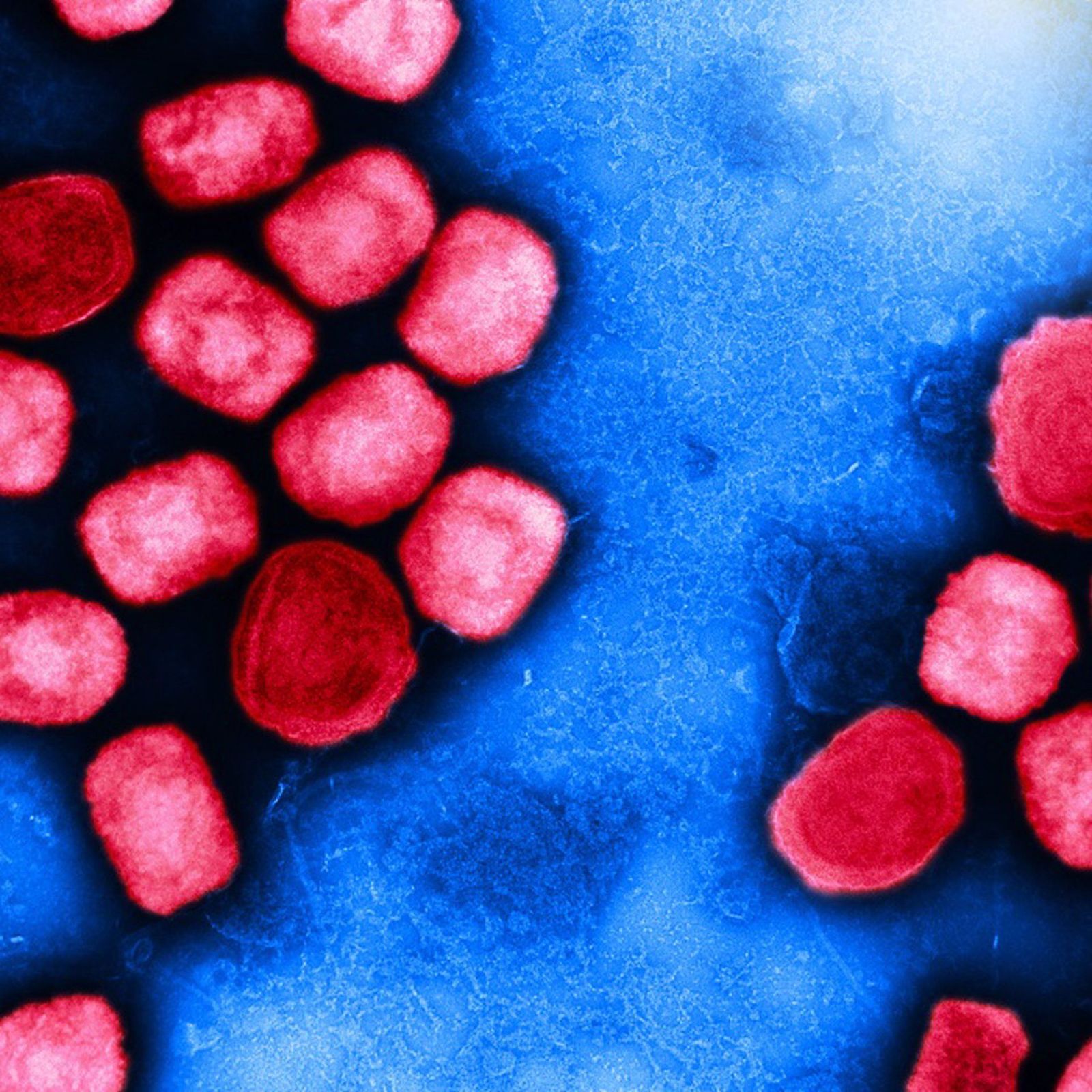 Micrografía electrónica de transmisión coloreada de partículas del virus de la viruela del mono (rojo) cultivadas y purificadas a partir de un cultivo celular. EP