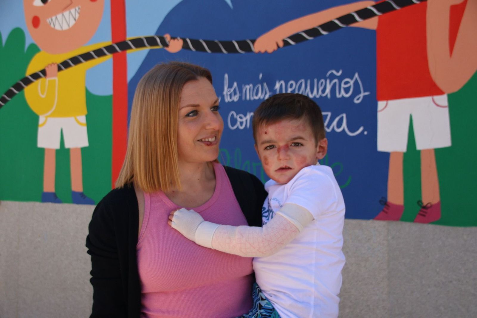 Carrera solidaria a favor de Piel de Mariposa