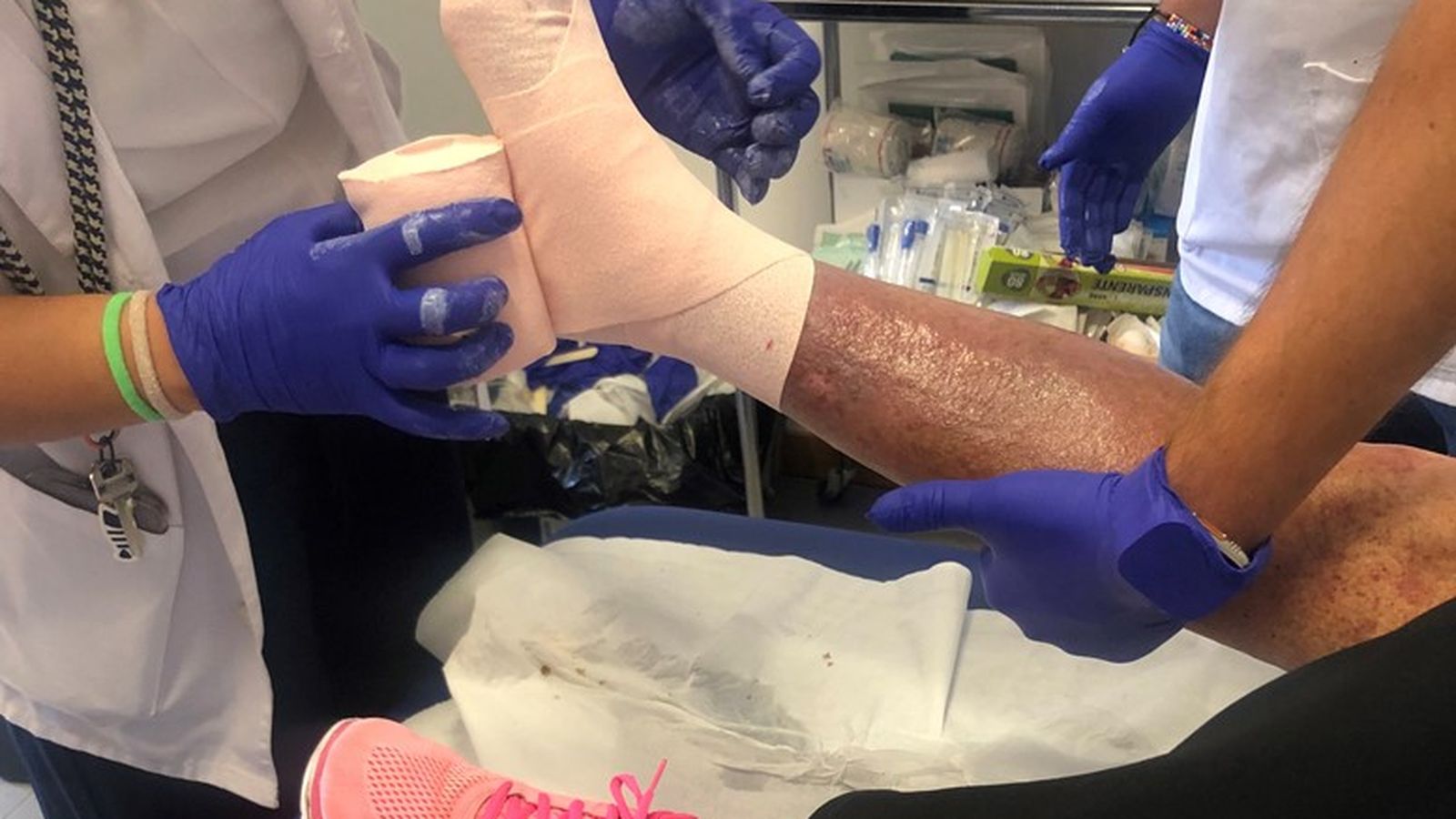 Unidad Funcional de Heridas Complejas en Salamanca