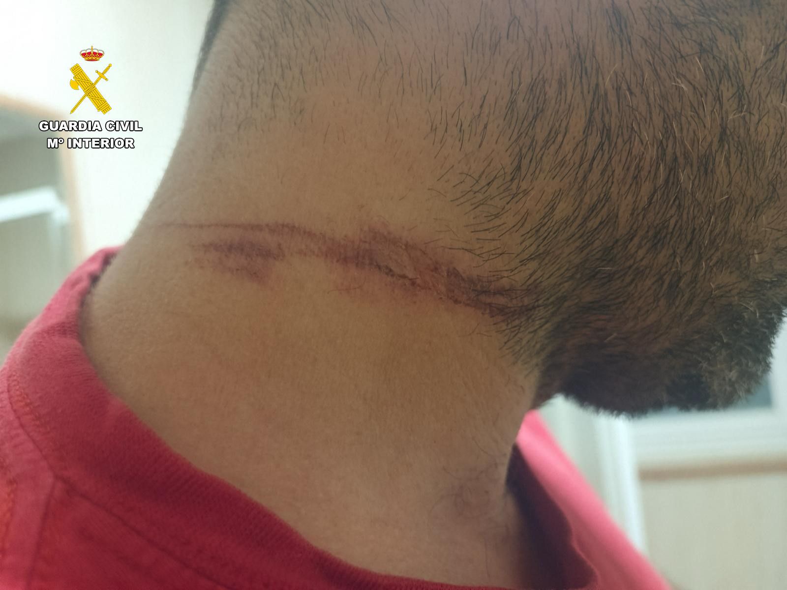 Hombre herido por una trampa en el campo de Salamanca