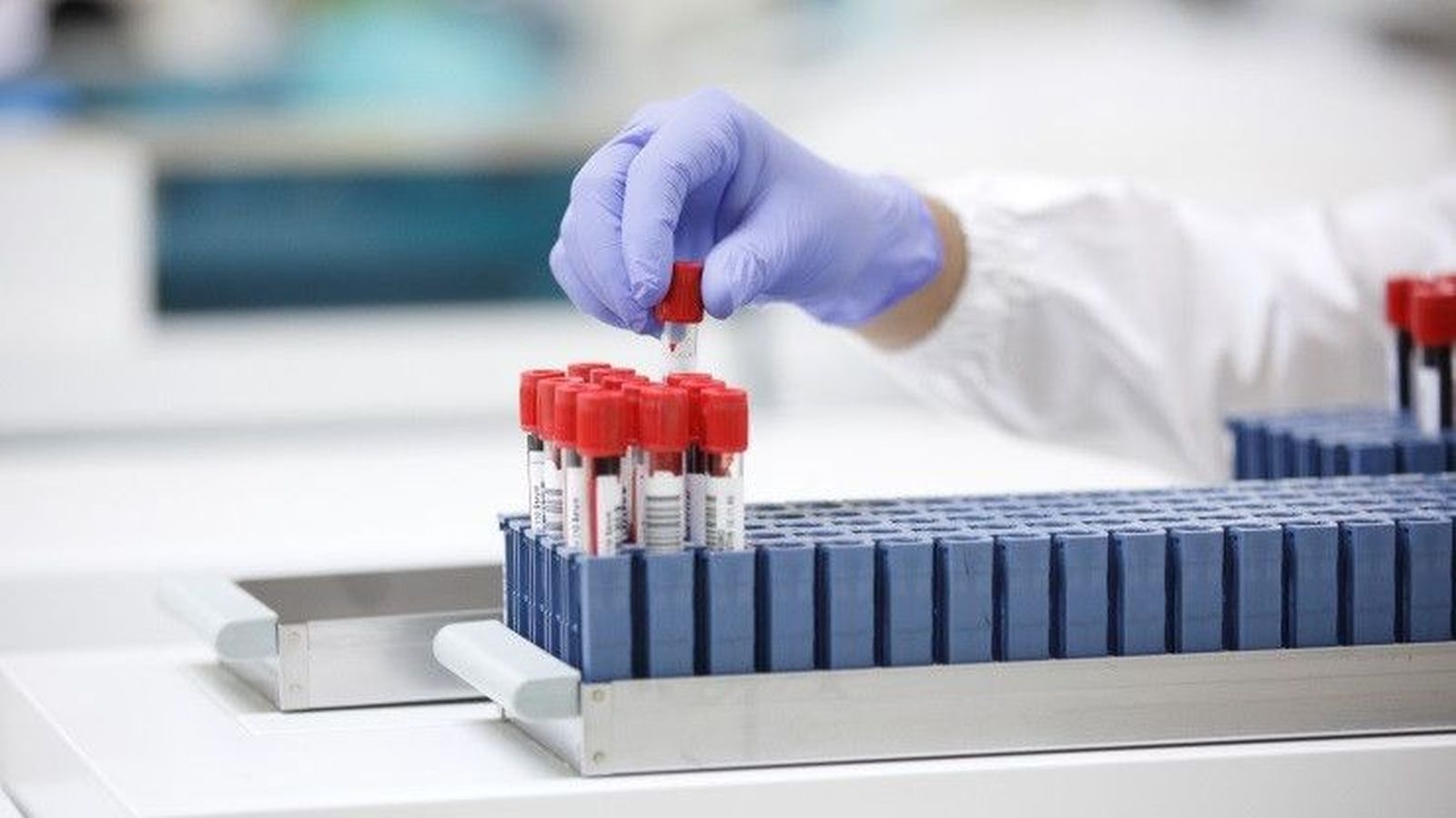 Investigadores determinan que las muertes por cáncer han subido hasta los 10 millones