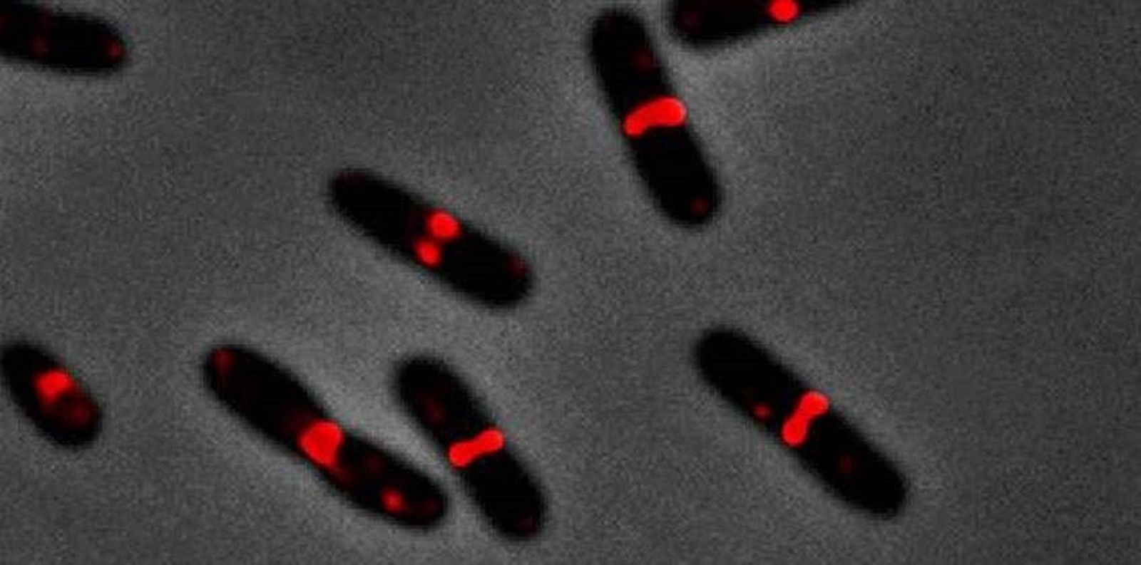 Bacterias Escherichia Coli, E. Coli