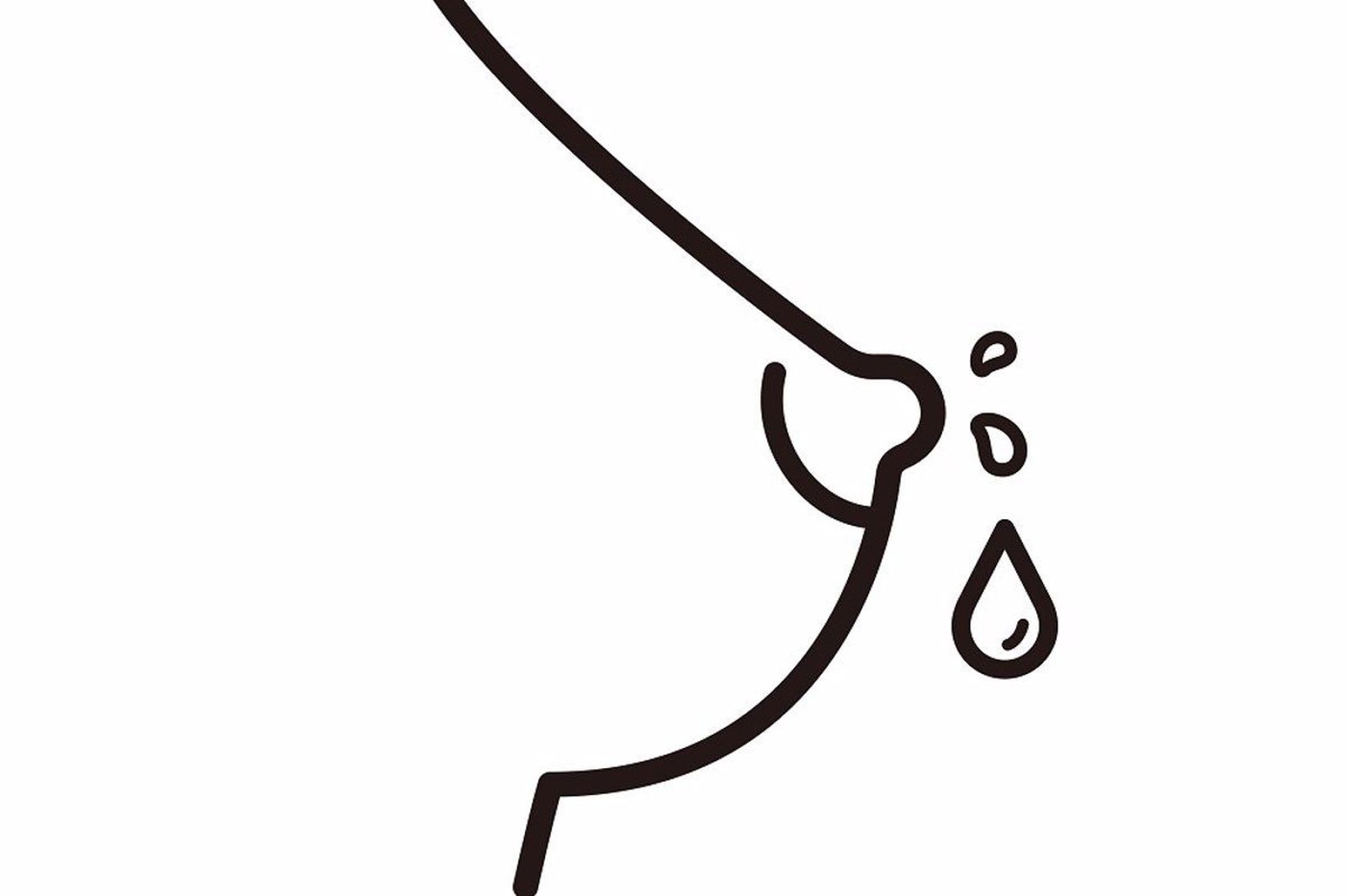 Galactorrea. Foto Infosalus