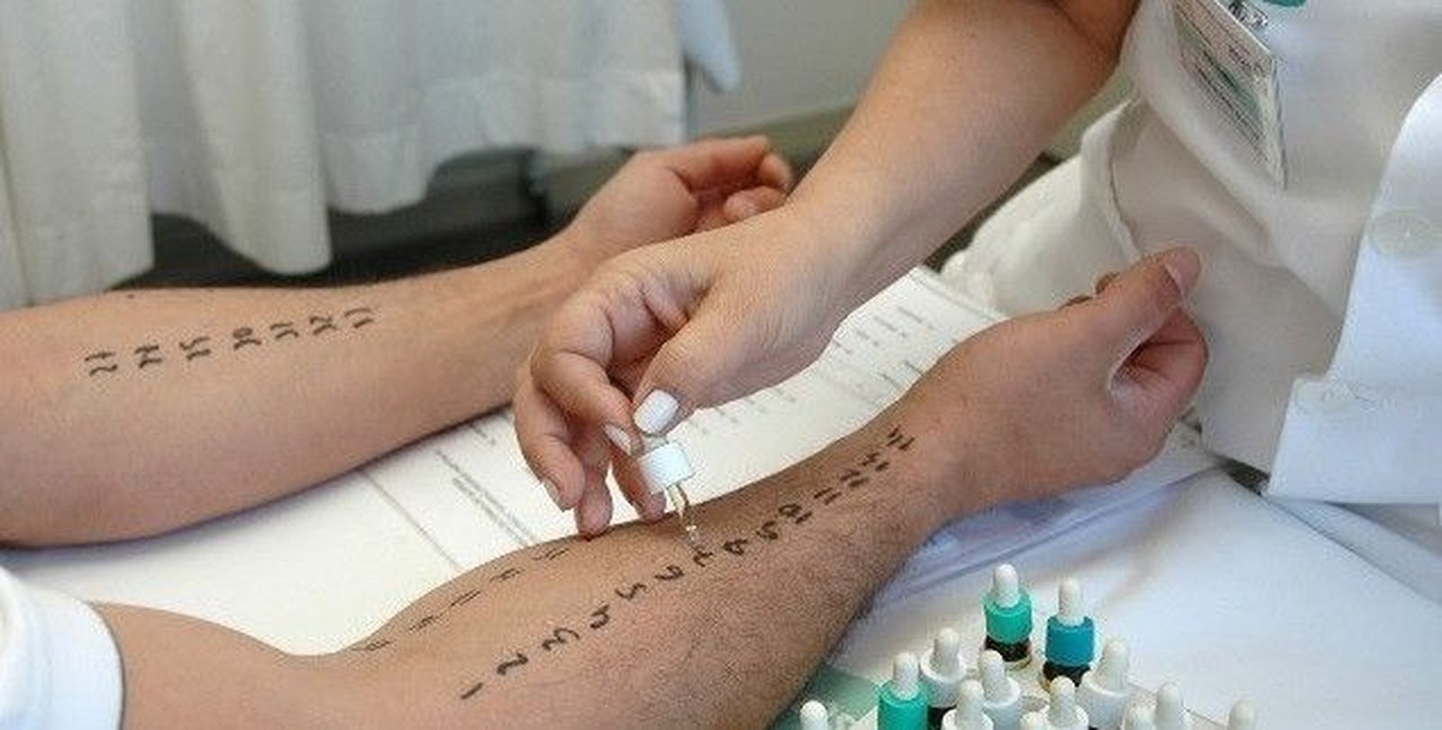 Ocho de cada diez personas ven afectada su vida diaria a causa de una alergia