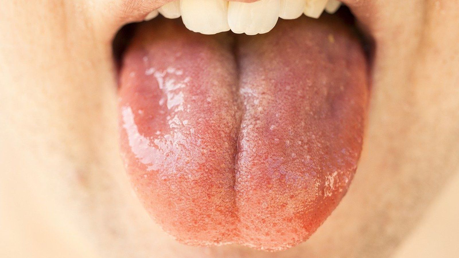 Los síntomas más desconocidos del coronavirus que pasan desapercibidos Los síntomas más desconocidos del coronavirus que pasan desapercibidos