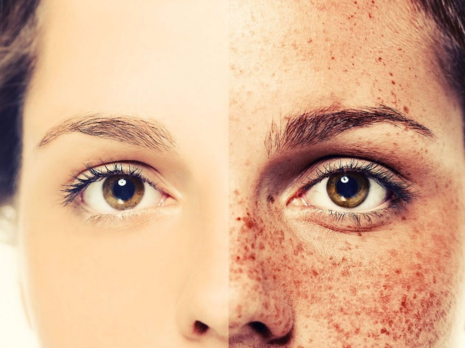 Cada vez más mujeres luchan por mantener a raya las manchas. EP