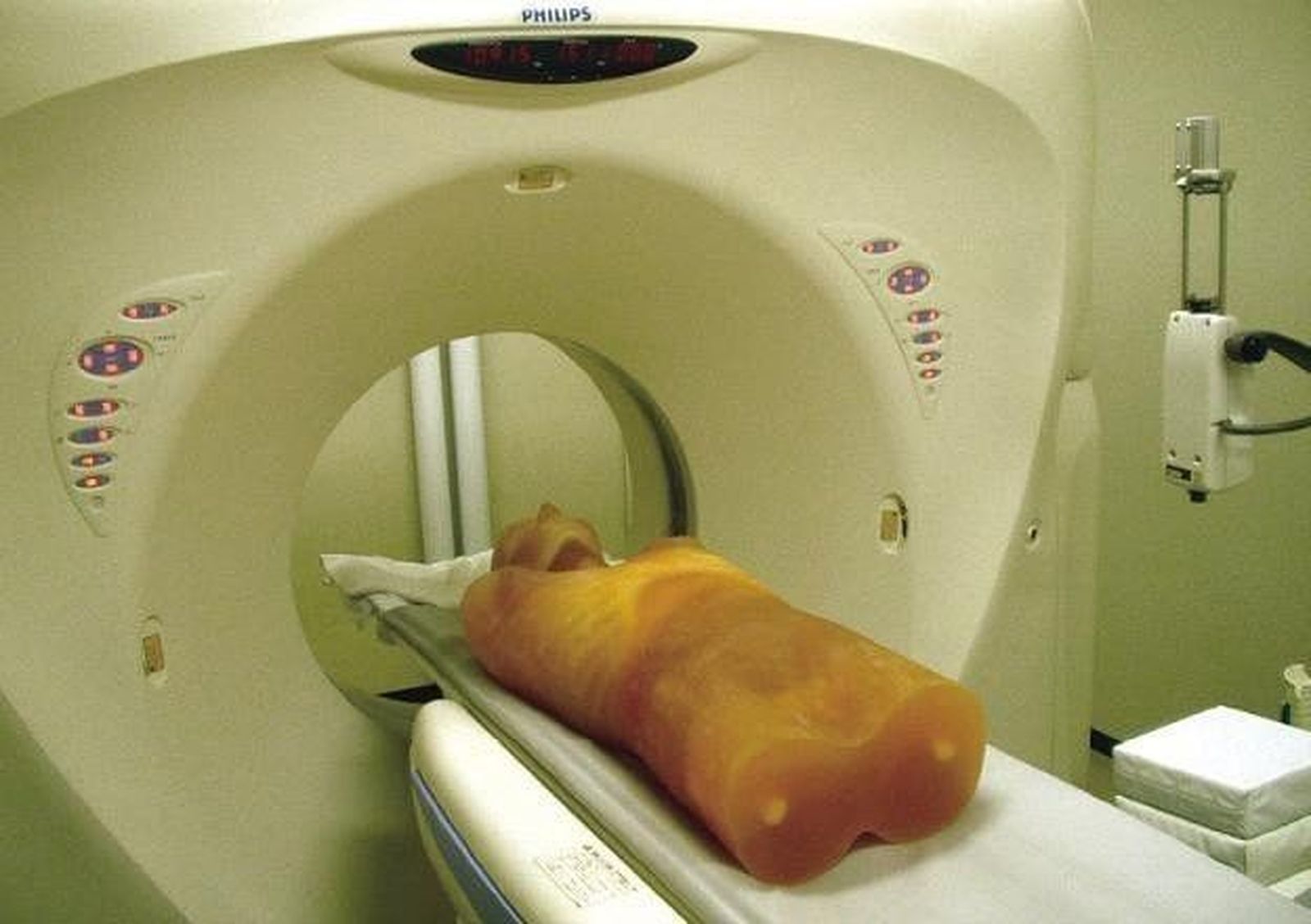 Casi 400.000 euros para mantenimiento de aceleradores lineales en el Complejo Asistencial