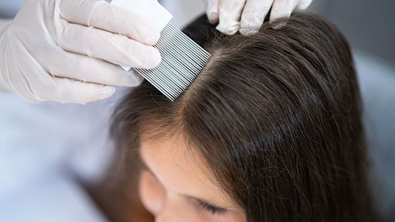 Tratamiento antipiojos