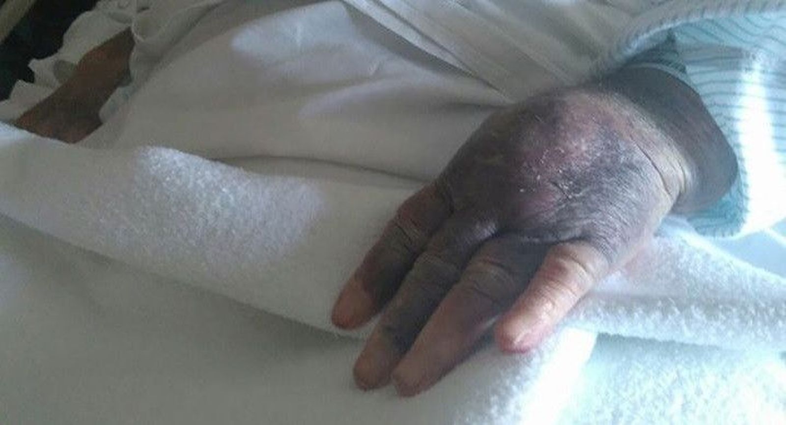 Denuncia viral contra el Hospital Virgen de la Concha