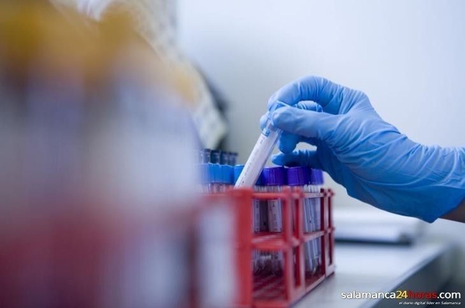 Mejoran la trazabilidad de las muestras en laboratorios hospitalarios